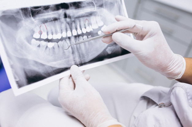 Dental Radyoloji